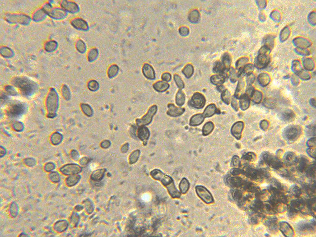 microorganismos