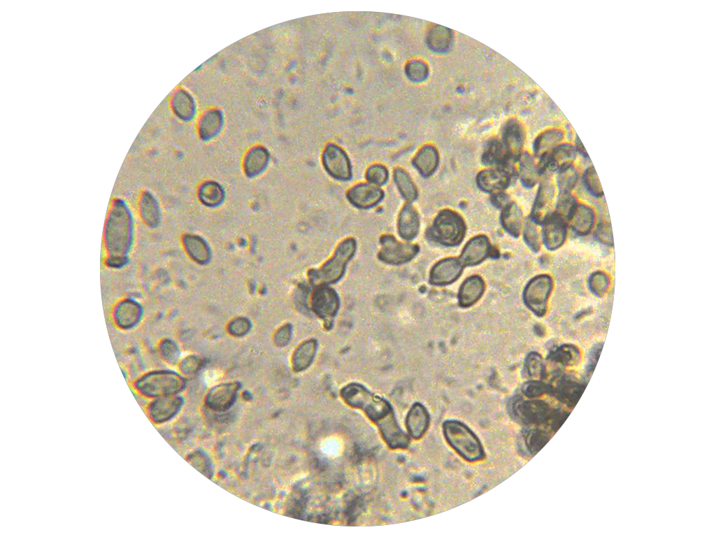 levadura